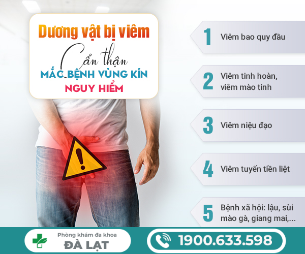 Hình ảnh minh họa